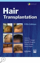 Hair Transplantation, Fifth Edition<br> By Walter Unger, M.D., Ronald Shapiro, M.D.,<br> Mark A. Unger, M.D. and Robin Unger, M.D.