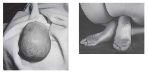 Edward Weston & Harry Callahan: He, She, It