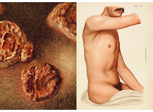 'The Sick Rose' Lecture and Book Signing at Morbid Anatomy Library