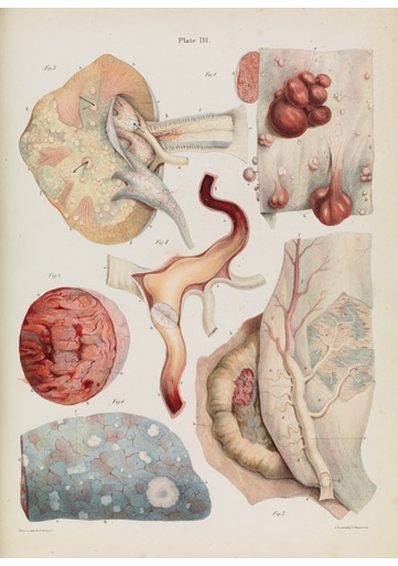 'The Sick Rose' Lecture and Book Signing at Morbid Anatomy Library