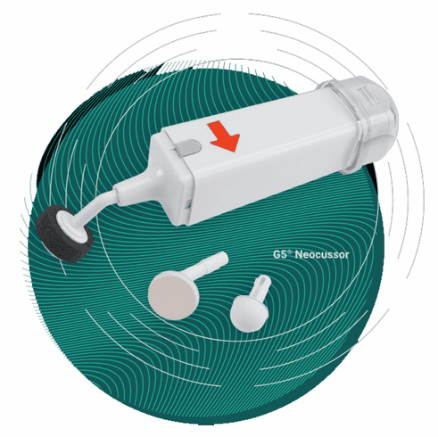 G5 Neocusser by General Physiotherapy