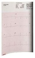 Precision Charts ECG EKG Thermal Paper Z-Fold – Mortara ELi 250/210/280/350 – 9100-026-01