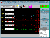 Cardio-Stress Test PC Software