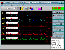 Cardio-Stress Test PC Software