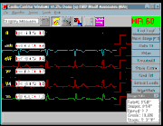 CardioStress PC-based Stress System Software CardioStress PC-based Stress System Software