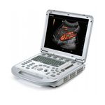 Echo Ultrasound Equipment