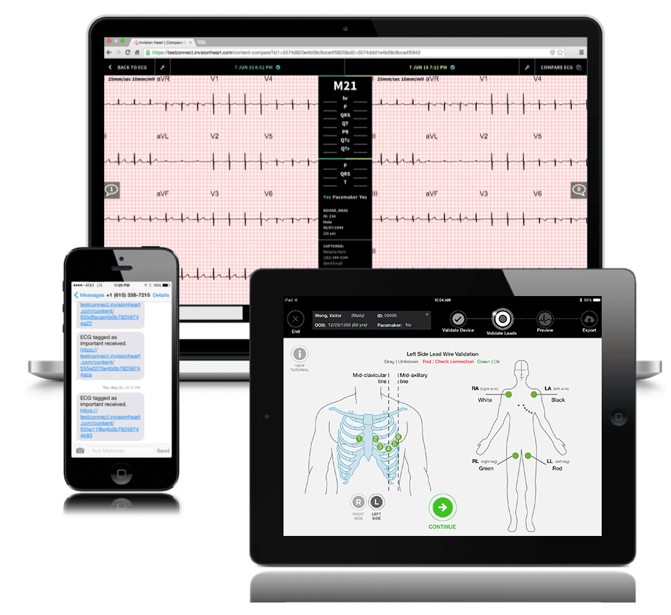 Lead Ecg Ecg Apple Se 12 Lead Ecg Apple Watch Ekg With Apple Watch Top