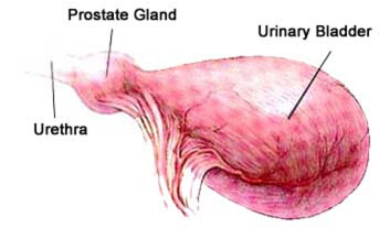 Urinary Incontinence