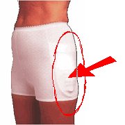 Hip Protectors & Osteoporosis