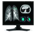 NEC 30" MultiSync Diagnostic Flat-Panel Monitor - MD212MC