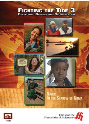 Niger: In the Shadow of Noma (Enhanced DVD)