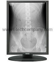 2 Mega-Pixel with ISD Technology 21.3" Monochrome Display with resolution of 6 mega sub-pixels for advanced image quality. (Model: MS21i2)