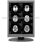 2MP Diagnostic Mono Display