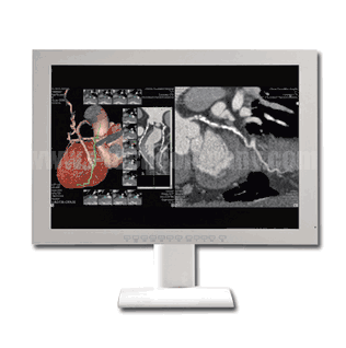 Medical Grade 24" Color Surgical Displays IPS True flat AG glass 1920x1200, 350nits, VGA + DVI + HDMI+DP+BNC-CVBS+Video+SDI DC24V power  (Model: GMM2400)
