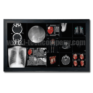 Medical Grade 58" Quad FHD 8MP LED Monitor with AR Glass 3840x2160, 700nits, 2DP+DVI (Model: GMM5800)