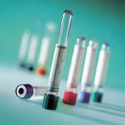 Blood CollectionTube <br>Evacuated Vacuette <br>K3 EDTA 6mL 13x100mm <br>Pink/Black 1200/Case <br>Greiner Vacuette 456067