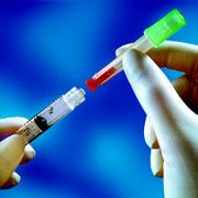  Cannula Dual Twinpak<BR> 20/ 17g Steel/ Plastic <BR>Disposable 100/Bx <BR> BD 303390