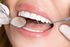 SuperStick 230, <br> Sticks, Light Body, Pink, 200+gms, <br> 1/bx , 5 box/Case <br> Pacdent 50280