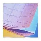 Cardioline Z-Fold EKG Chart Paper (874.5555)