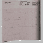 Mortara Roll EKG Chart Paper (9100‑029‑01) (9100‑029‑50) for ELI230