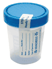 Sterile Urine Specimen Containers 100/CS (P250400)