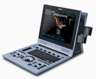 Edan U60 Color Diagnostic Ultrasound System from $6,559 with Transducer Included