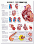 "HEART CONDITIONS" LAMINATED ANATOMICAL CHART