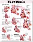 "HEART DISEASES" LAMINATED ANATOMICAL CHART