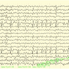 Nihon Kohden 18-Channel EEG Paper (PA18‑345C/H)