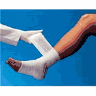 UNNA BOOT PASTE BANDAGES PLAIN or CALAMINE