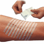 WOUND CLOSURE STRIPS