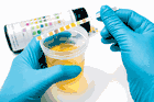 Urinalysis Reagent Test Strips