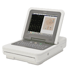 What is an EKG Machine and How Does It Work?