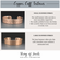 Personalized Copper Medical Alert Bracelet - Hammered Medical ID Cuff
