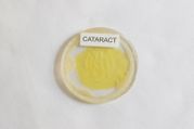 Cataract Lens