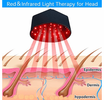 UTK LED Red Light Therapy Device For Head - Scalp Care and Hair Protection Cap