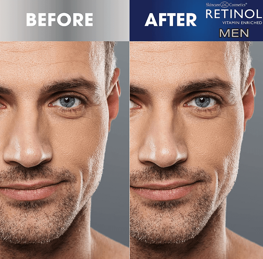 RETINOL Daily Moisturizer for Men [44401-000]