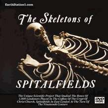 The Skeletons Of Spitalfields MP4 Video Download DVD The Skeletons Of Spitalfields MP4 Video Download DVD