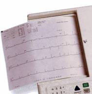 ECG Paper  8.5 x11   Z-Fold 150 Sheets/Pack  8 Packs/Case