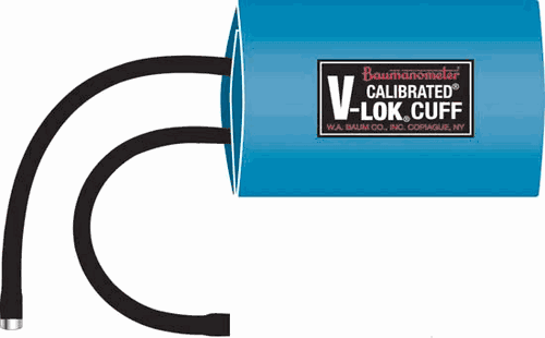 Baum Calibrated™ V-Lok™ Cuff & Inflation Bag (2‑Tubes) THIGH  (1884)
