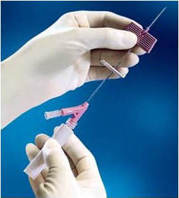 BD Saf-T-Intima ™ I.V. Catheter 24G x 0.75" with "Y"  Adapter (383313)