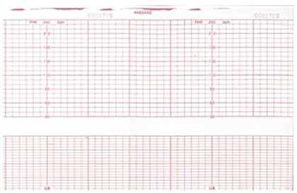Corometrics 4483AAO Fetal Monitoring Chart Paper Roll