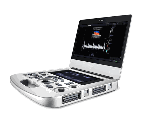 Edan Point-of-Care Ultrasound System AX3