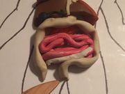 Gastrointestinal Part 2: Lower GI