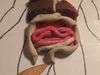 Gastrointestinal Part 2: Lower GI Gastrointestinal Part 2: Lower GI