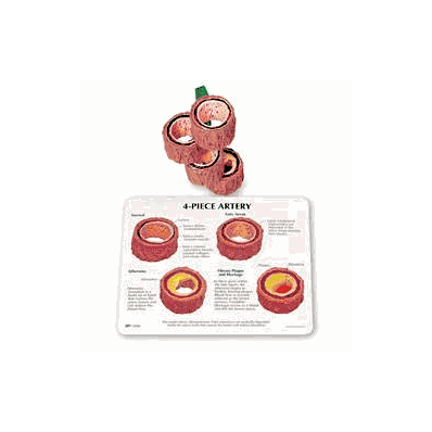 4-piece Artery Model - Model, Artery 4pc - N