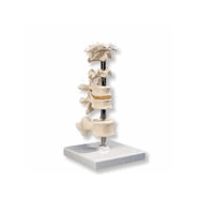 6 Mounted Vertebrae