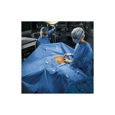 Abdominal Drape Laparoscopic / Abdominal Drap