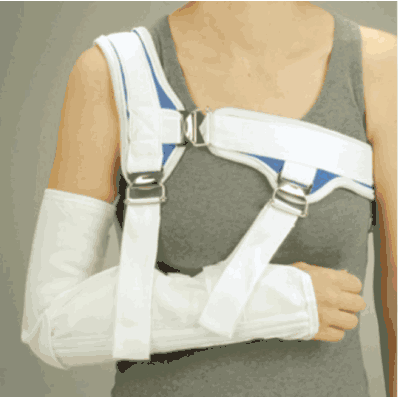 Acromioclavicular Splint, universal, white