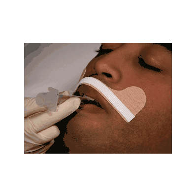 Adhesive Base Stabilock